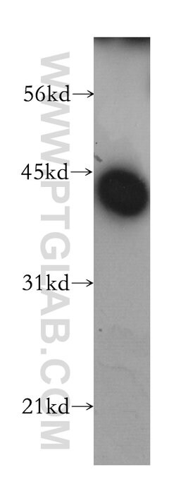 LRG1 Rabbit anti-Human, Mouse, Polyclonal, Proteintech 150 μL; Unconjugated:Antibodies,