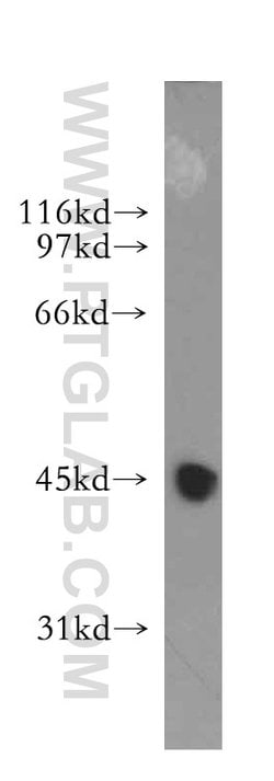 LRG1 Rabbit anti-Human, Mouse, Polyclonal, Proteintech 150 μL; Unconjugated:Antibodies,