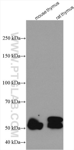 RCBTB2 Rabbit anti-Human, Mouse, Rat, Polyclonal, Proteintech:Antibodies:Primary