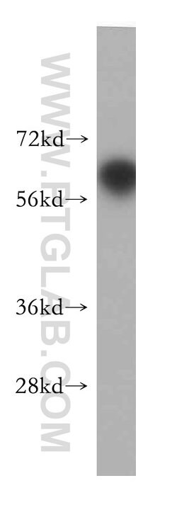 RCBTB2 Rabbit anti-Human, Mouse, Rat, Polyclonal, Proteintech:Antibodies:Primary