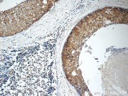 ARSB Rabbit anti-Human, Mouse, Rat, Polyclonal, Proteintech:Antibodies:Primary