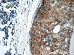 ARSB Rabbit anti-Human, Mouse, Rat, Polyclonal, Proteintech:Antibodies:Primary