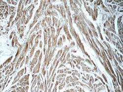 ARSB Rabbit anti-Human, Mouse, Rat, Polyclonal, Proteintech:Antibodies:Primary