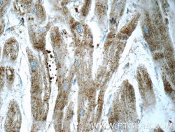 ARSB Rabbit anti-Human, Mouse, Rat, Polyclonal, Proteintech:Antibodies:Primary