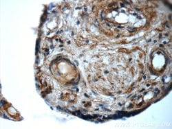 ARSB Rabbit anti-Human, Mouse, Rat, Polyclonal, Proteintech:Antibodies:Primary
