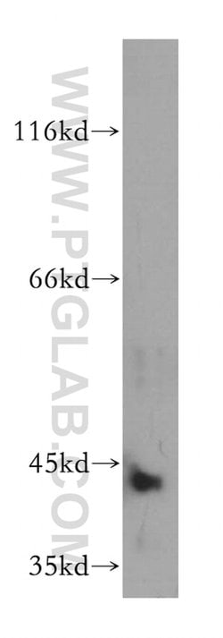 ARSB Rabbit anti-Human, Mouse, Rat, Polyclonal, Proteintech:Antibodies:Primary