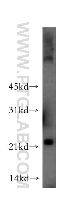 MYL4 Rabbit anti-Human, Mouse, Rat, Polyclonal, Proteintech:Antibodies:Primary