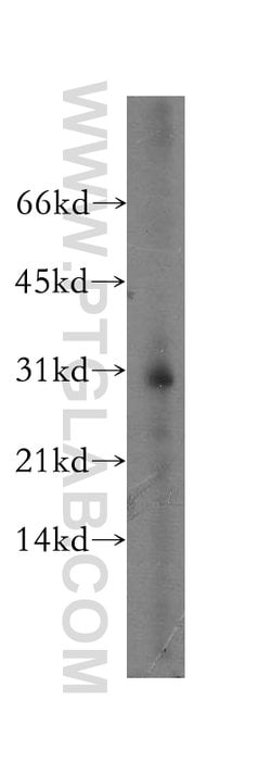 ATP6V1E2 Rabbit anti-Human, Mouse, Rat, Polyclonal, Proteintech 150 &mu;L;