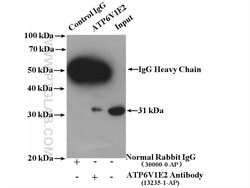 ATP6V1E2 Rabbit anti-Human, Mouse, Rat, Polyclonal, Proteintech 150 &mu;L;