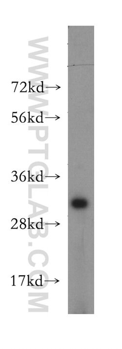 ATP6V1E2 Rabbit anti-Human, Mouse, Rat, Polyclonal, Proteintech 150 &mu;L;