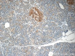 SCRN3 Rabbit anti-Human, Mouse, Rat, Polyclonal, Proteintech:Antibodies:Primary