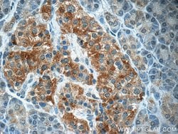 SCRN3 Rabbit anti-Human, Mouse, Rat, Polyclonal, Proteintech:Antibodies:Primary