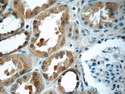 SCRN3 Rabbit anti-Human, Mouse, Rat, Polyclonal, Proteintech:Antibodies:Primary