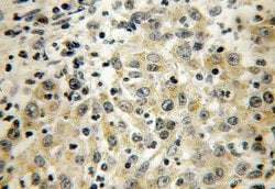 CYP4F12 Rabbit anti-Human, Mouse, Polyclonal, Proteintech 150 &mu;L; Unconjugated:Antibodies,