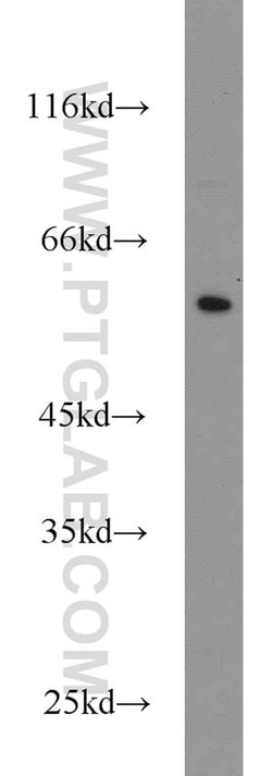 CYP4F12 Rabbit anti-Human, Mouse, Polyclonal, Proteintech 150 &mu;L; Unconjugated:Antibodies,