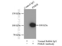 PI4KB Rabbit anti-Human, Mouse, Rat, Polyclonal, Proteintech 150 &mu;L;