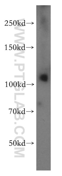 PI4KB Rabbit anti-Human, Mouse, Rat, Polyclonal, Proteintech 150 &mu;L;