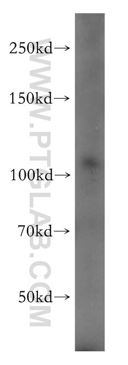 PI4KB Rabbit anti-Human, Mouse, Rat, Polyclonal, Proteintech 150 &mu;L;