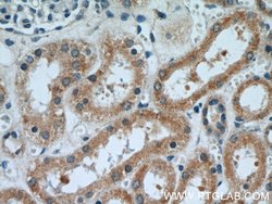 SRGAP1 Rabbit anti-Human, Mouse, Rat, Polyclonal, Proteintech 150 &mu;L;