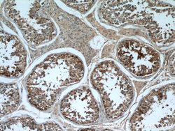 SRGAP1 Rabbit anti-Human, Mouse, Rat, Polyclonal, Proteintech 150 &mu;L;