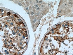 SRGAP1 Rabbit anti-Human, Mouse, Rat, Polyclonal, Proteintech 150 &mu;L;