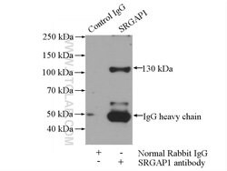 SRGAP1 Rabbit anti-Human, Mouse, Rat, Polyclonal, Proteintech 150 &mu;L;