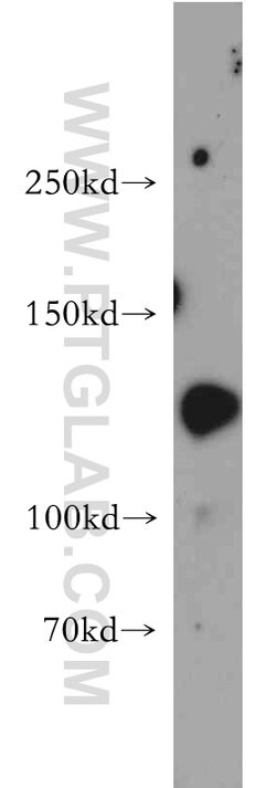SRGAP1 Rabbit anti-Human, Mouse, Rat, Polyclonal, Proteintech 150 &mu;L;