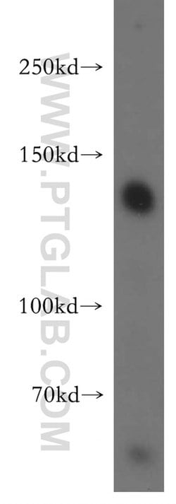 SRGAP1 Rabbit anti-Human, Mouse, Rat, Polyclonal, Proteintech 150 &mu;L;