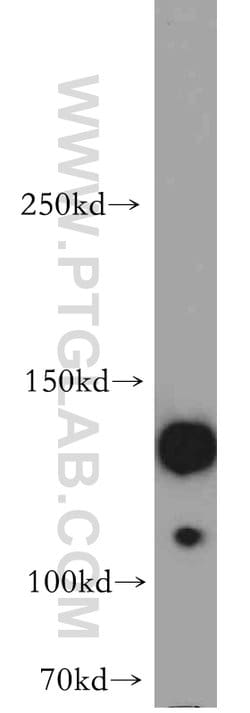 SRGAP1 Rabbit anti-Human, Mouse, Rat, Polyclonal, Proteintech 150 &mu;L;