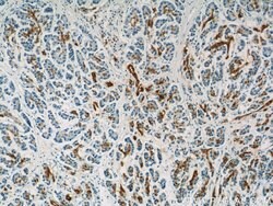 Gamma adaptin Rabbit anti-Human, Mouse, Rat, Polyclonal, Proteintech:Antibodies:Primary