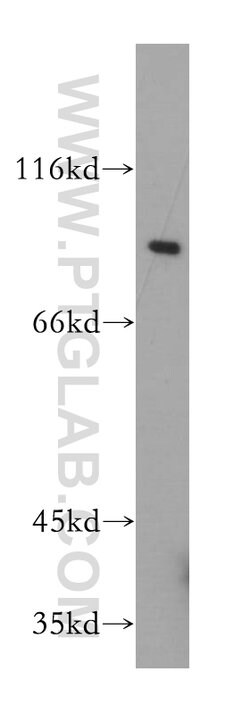 Gamma adaptin Rabbit anti-Human, Mouse, Rat, Polyclonal, Proteintech:Antibodies:Primary