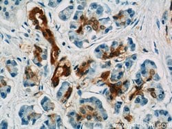 Gamma adaptin Rabbit anti-Human, Mouse, Rat, Polyclonal, Proteintech:Antibodies:Primary