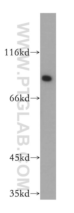 Gamma adaptin Rabbit anti-Human, Mouse, Rat, Polyclonal, Proteintech:Antibodies:Primary