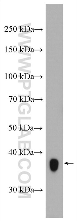 GGH Rabbit anti-Human, Mouse, Rat, Polyclonal, Proteintech 150 &mu;L; Unconjugated:Antibodies,