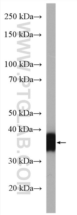 GGH Rabbit anti-Human, Mouse, Rat, Polyclonal, Proteintech 150 &mu;L; Unconjugated:Antibodies,