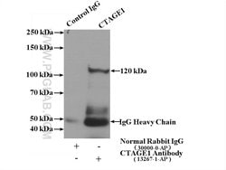 CTAGE1 Rabbit anti-Human, Polyclonal, Proteintech 150 &mu;L; Unconjugated:Antibodies,
