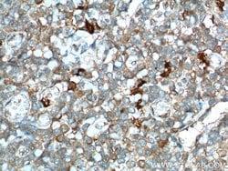 IDO1 Rabbit anti-Human, Polyclonal, Proteintech:Antibodies:Primary Antibodies