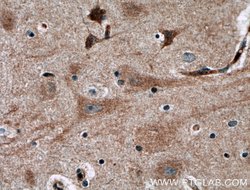 NGEF Rabbit anti-Human, Mouse, Polyclonal, Proteintech:Antibodies:Primary
