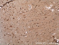 NGEF Rabbit anti-Human, Mouse, Polyclonal, Proteintech:Antibodies:Primary