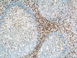 TRAT1 Rabbit anti-Human, Mouse, Rat, Polyclonal, Proteintech:Antibodies:Primary