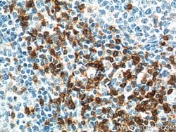 TRAT1 Rabbit anti-Human, Mouse, Rat, Polyclonal, Proteintech:Antibodies:Primary