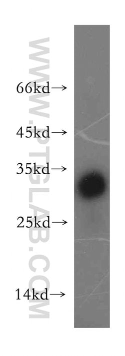TRAT1 Rabbit anti-Human, Mouse, Rat, Polyclonal, Proteintech:Antibodies:Primary