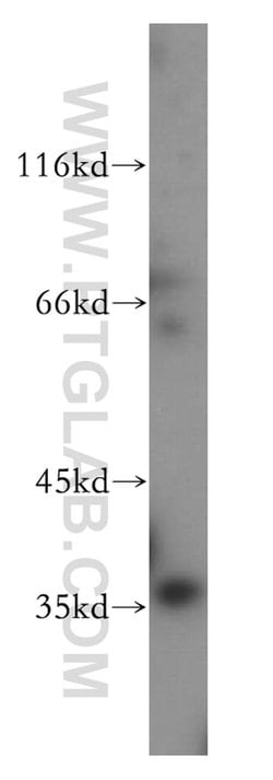 PARVG Rabbit anti-Human, Mouse, Rat, Polyclonal, Proteintech 150 &mu;L;