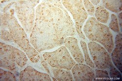 ZBP1 Rabbit anti-Human, Polyclonal, Proteintech:Antibodies:Primary Antibodies