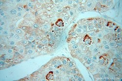 ZBP1 Rabbit anti-Human, Polyclonal, Proteintech:Antibodies:Primary Antibodies
