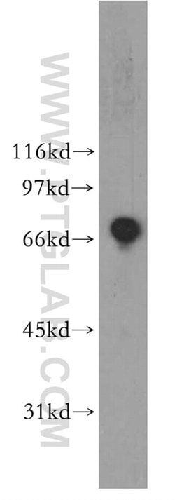 ZBP1 Rabbit anti-Human, Polyclonal, Proteintech:Antibodies:Primary Antibodies