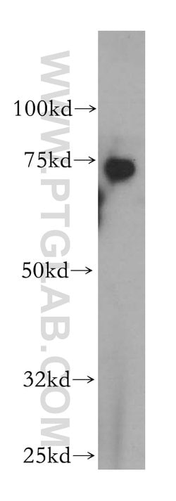 ZBP1 Rabbit anti-Human, Polyclonal, Proteintech:Antibodies:Primary Antibodies