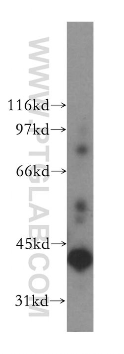 ADH6 Rabbit anti-Human, Polyclonal, Proteintech:Antibodies:Primary Antibodies