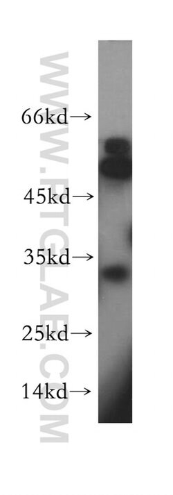 RDH12 Rabbit anti-Human, Mouse, Rat, Polyclonal, Proteintech 150 &mu;L;
