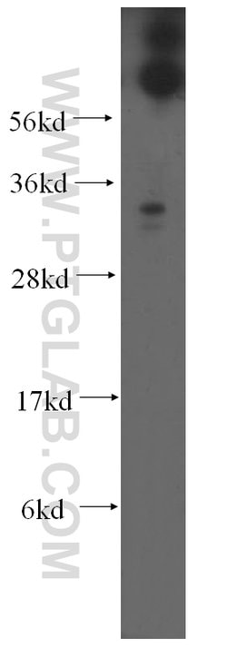 RDH12 Rabbit anti-Human, Mouse, Rat, Polyclonal, Proteintech 150 &mu;L;